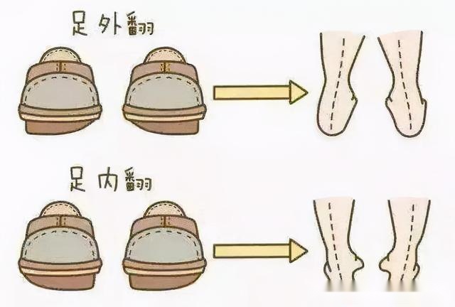 刘涛也内八字？X型腿如何破？做好这2步细直疏影腿你也有